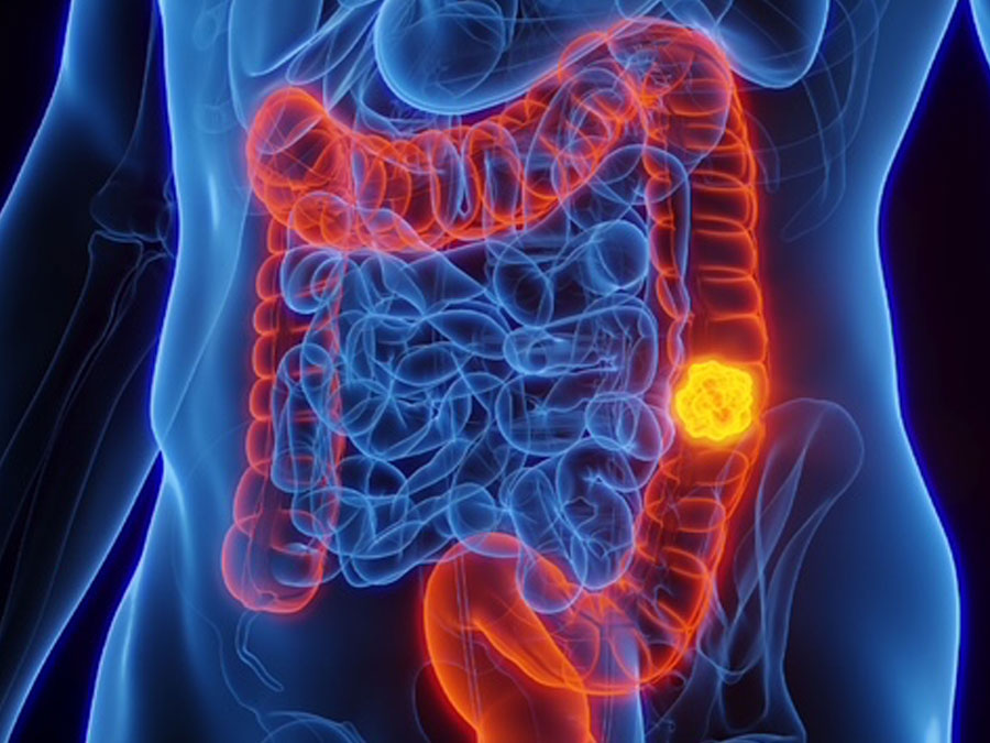 Digestive health
